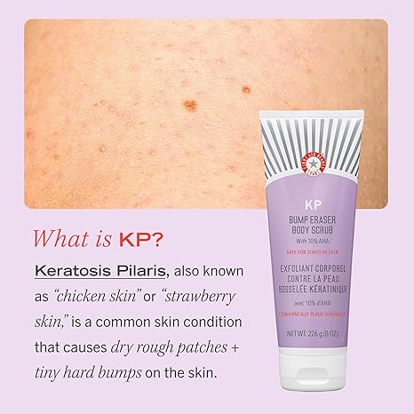 First Aid Beauty KP Bump Eraser Body Scrub Exfoliant for Keratosis Pilaris with 10% AHA â€“ 2 8oz Tubes, 16 oz Total