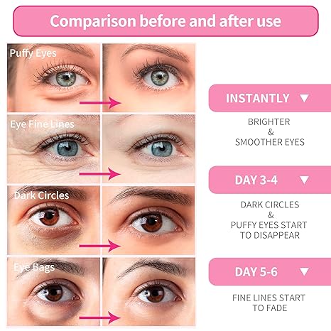 BREYLEE Rose Eye Mask– 30 Pairs – Eye Treatment Mask, Under Eye Bags Treatment, Under Eye Masks for Puffy Eyes, Anti-Aging,Anti-Wrinkle and Fine Lines, Under eye Dark Circles